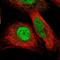 DnaJ Heat Shock Protein Family (Hsp40) Member C17 antibody, NBP1-84614, Novus Biologicals, Immunofluorescence image 