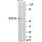 Docking Protein 3 antibody, PA5-49841, Invitrogen Antibodies, Western Blot image 
