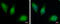 Hexokinase Domain Containing 1 antibody, GTX111506, GeneTex, Immunofluorescence image 