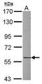 Unc-5 Family C-Terminal Like antibody, PA5-30917, Invitrogen Antibodies, Western Blot image 