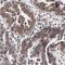 Nuclear Transport Factor 2 antibody, FNab05880, FineTest, Immunohistochemistry frozen image 