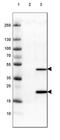 Asparaginase Like 1 antibody, NBP2-42378, Novus Biologicals, Western Blot image 