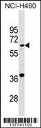 Glutamyl-TRNA Amidotransferase Subunit B antibody, 59-394, ProSci, Western Blot image 