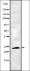 Eukaryotic Translation Elongation Factor 1 Beta 2 antibody, orb337333, Biorbyt, Western Blot image 