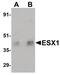 ESX Homeobox 1 antibody, PA5-20896, Invitrogen Antibodies, Western Blot image 