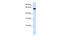 Heparan Sulfate 6-O-Sulfotransferase 3 antibody, 26-377, ProSci, Enzyme Linked Immunosorbent Assay image 