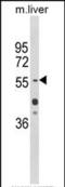 Hepatocyte nuclear factor 1-alpha antibody, PA5-35356, Invitrogen Antibodies, Western Blot image 