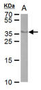 Cre Recombinase antibody, GTX629479, GeneTex, Western Blot image 