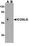 B7RP-1 antibody, A01965, Boster Biological Technology, Western Blot image 