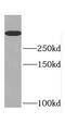 Death Inducer-Obliterator 1 antibody, FNab02388, FineTest, Western Blot image 