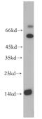 Microtubule Associated Protein 1 Light Chain 3 Alpha antibody, 18722-1-AP, Proteintech Group, Western Blot image 