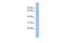 Mucolipin 3 antibody, GTX47669, GeneTex, Western Blot image 