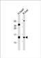 Translocase Of Inner Mitochondrial Membrane 10B antibody, PA5-72293, Invitrogen Antibodies, Western Blot image 