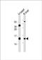 Translocase Of Inner Mitochondrial Membrane 10B antibody, PA5-72293, Invitrogen Antibodies, Western Blot image 