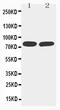 TNF Receptor Superfamily Member 1B antibody, PA1243, Boster Biological Technology, Western Blot image 