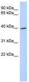 Tribbles Pseudokinase 1 antibody, TA340200, Origene, Western Blot image 