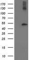 Tubulin beta-4 chain antibody, CF503130, Origene, Western Blot image 