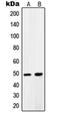 Pyruvate Dehydrogenase Kinase 1 antibody, orb214375, Biorbyt, Western Blot image 
