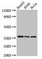Enoyl-CoA Hydratase 1 antibody, LS-C670974, Lifespan Biosciences, Western Blot image 
