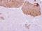 Interleukin 22 Receptor Subunit Alpha 2 antibody, GTX103302, GeneTex, Immunohistochemistry paraffin image 