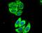 Interleukin 13 Receptor Subunit Alpha 1 antibody, NBP2-75538, Novus Biologicals, Immunocytochemistry image 