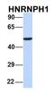 Heterogeneous Nuclear Ribonucleoprotein H1 antibody, orb326259, Biorbyt, Western Blot image 