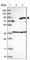 GUSB antibody, HPA036323, Atlas Antibodies, Western Blot image 