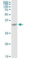 Voltage Dependent Anion Channel 2 antibody, H00007417-M01, Novus Biologicals, Western Blot image 