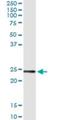 Ubiquitin Conjugating Enzyme E2 T antibody, H00029089-M03, Novus Biologicals, Immunoprecipitation image 