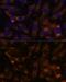 Succinate-CoA Ligase GDP-Forming Beta Subunit antibody, GTX66548, GeneTex, Immunocytochemistry image 