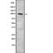 Ectonucleotide Pyrophosphatase/Phosphodiesterase 3 antibody, PA5-67955, Invitrogen Antibodies, Western Blot image 