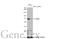 Succinate Dehydrogenase Complex Flavoprotein Subunit A antibody, GTX636335, GeneTex, Western Blot image 