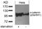 Catenin Alpha 1 antibody, PA5-37542, Invitrogen Antibodies, Western Blot image 