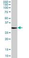 Proteinase 3 antibody, H00005657-D01P, Novus Biologicals, Western Blot image 