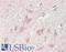 CD226 Molecule antibody, LS-B14035, Lifespan Biosciences, Immunohistochemistry paraffin image 