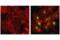 HIF1-alpha antibody, 36169S, Cell Signaling Technology, Immunofluorescence image 