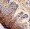 DNA Topoisomerase II Alpha antibody, LS-C160114, Lifespan Biosciences, Immunohistochemistry paraffin image 