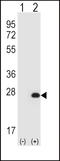 Hypoxanthine Phosphoribosyltransferase 1 antibody, LS-C165004, Lifespan Biosciences, Western Blot image 