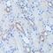 Low Density Lipoprotein Receptor Adaptor Protein 1 antibody, GTX64629, GeneTex, Immunohistochemistry paraffin image 