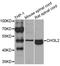 Chitinase 3 Like 2 antibody, STJ29968, St John