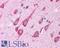 Microtubule Associated Protein 1 Light Chain 3 Beta antibody, LS-C83716, Lifespan Biosciences, Immunohistochemistry paraffin image 