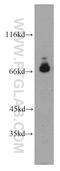 DNA Polymerase Alpha 2, Accessory Subunit antibody, 21778-1-AP, Proteintech Group, Western Blot image 