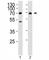 CD46 Molecule antibody, F48870-0.4ML, NSJ Bioreagents, Immunohistochemistry paraffin image 