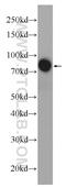 Afamin antibody, 25280-1-AP, Proteintech Group, Western Blot image 