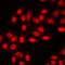 Enhancer Of Zeste 2 Polycomb Repressive Complex 2 Subunit antibody, LS-C668256, Lifespan Biosciences, Immunofluorescence image 