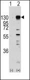 Fibroblast Growth Factor Receptor 1 antibody, PA5-14649, Invitrogen Antibodies, Western Blot image 