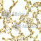 DnaJ Heat Shock Protein Family (Hsp40) Member B1 antibody, A5504, ABclonal Technology, Immunohistochemistry paraffin image 