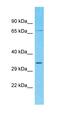 Transmembrane Protein 169 antibody, orb327126, Biorbyt, Western Blot image 