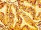 Growth Factor Receptor Bound Protein 14 antibody, LS-C670251, Lifespan Biosciences, Immunohistochemistry paraffin image 