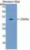 Keratin 5 antibody, LS-C302140, Lifespan Biosciences, Western Blot image 